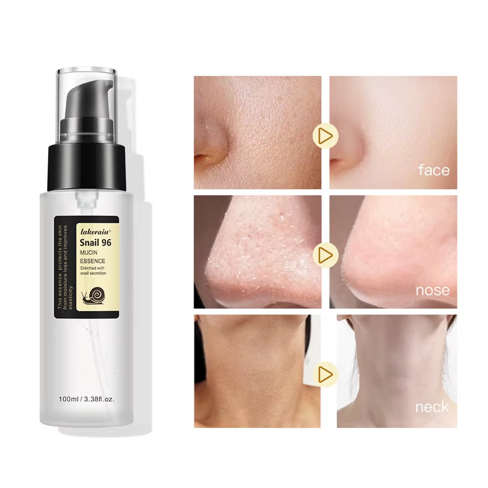 Snail Serum 96% Power Repairing Essence Lift Firm Anti-Aging Fade Fine Lines Acne Treatment Facial Sensitive Whitening 100Ml