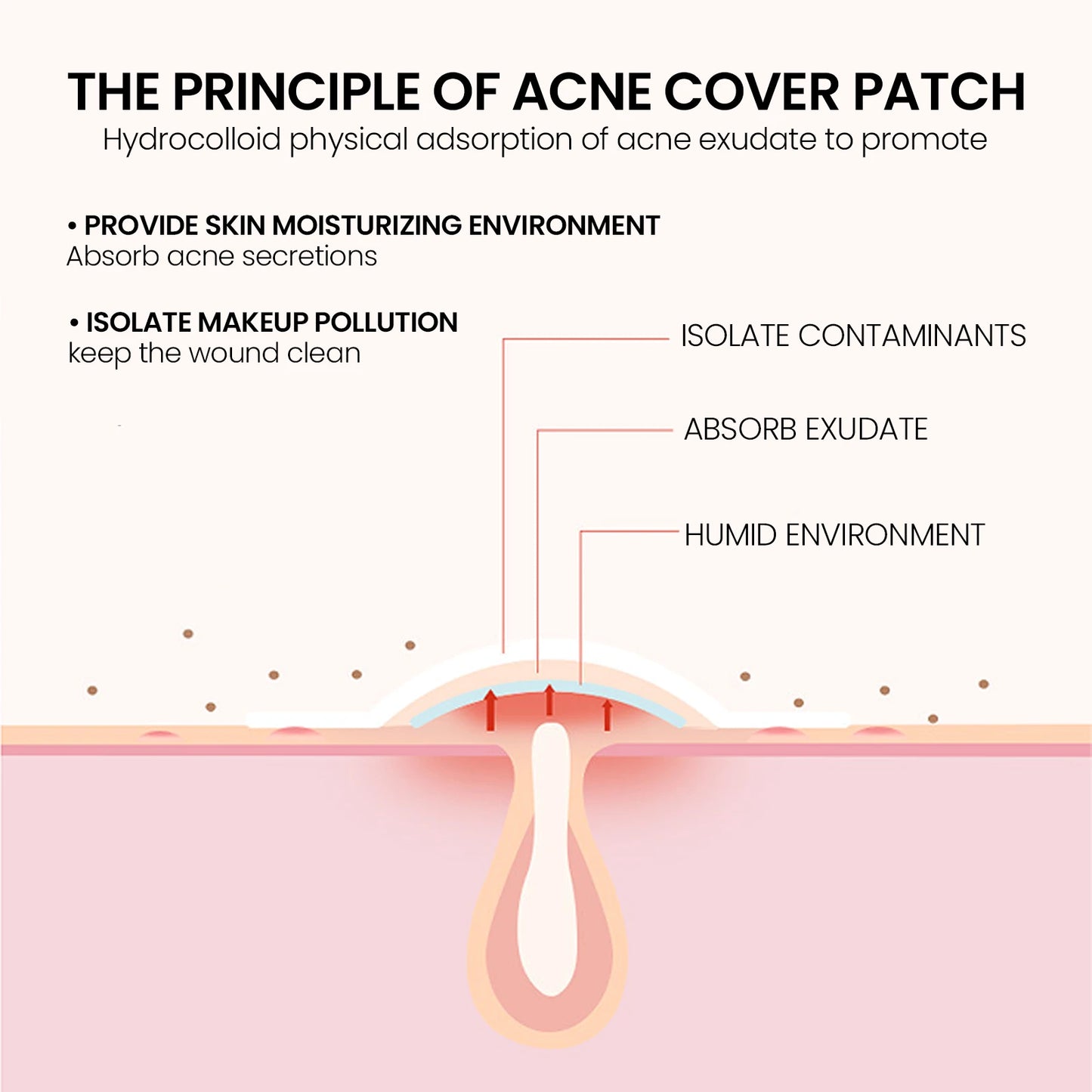 Pimple Patches Deep Clean Gentle Non-Irritating Facial Treatment Acne Removal Waterproof Beauty Skincare Concealer Pimple Marks