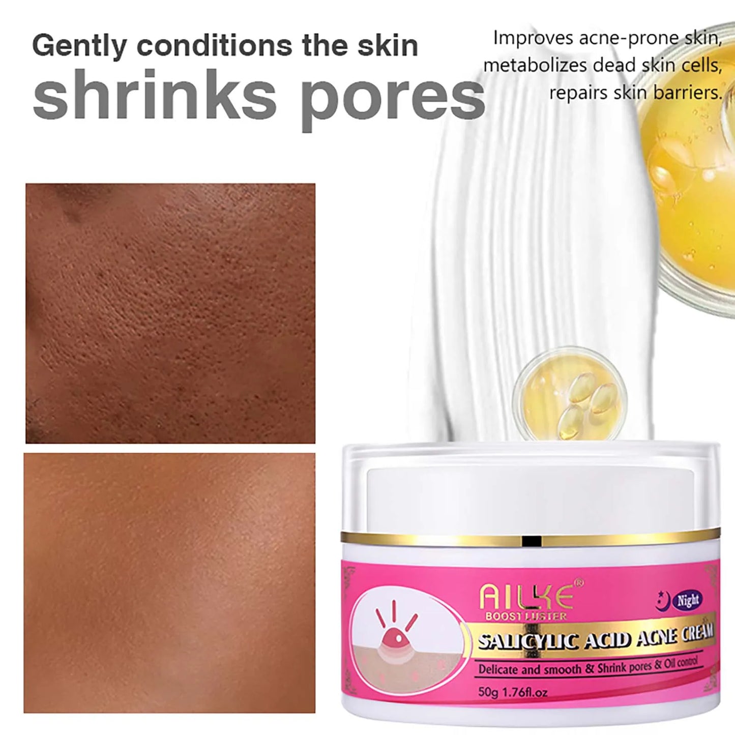 Organic Acne Face Cream, Cleaning Skin, Remove Blemish, Pimples, Non-Greasy, Oil Control, for Women and Men