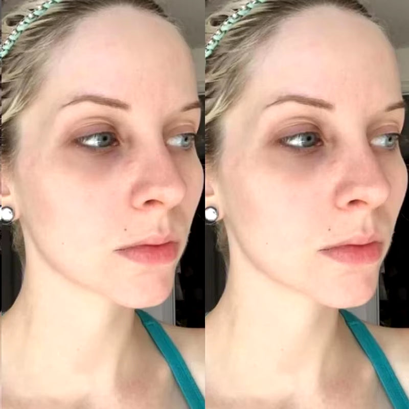 Facial Collagen Peptide Essence Mask Kit Hyaluronic Acid Moisturising Firm Lift Pore Shrinkage Skin Rejuvenation Skin Care